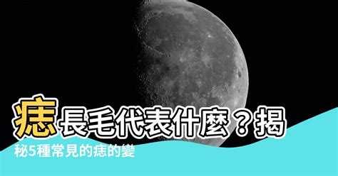 痣長毛代表什麼|痣上長毛代表什麼